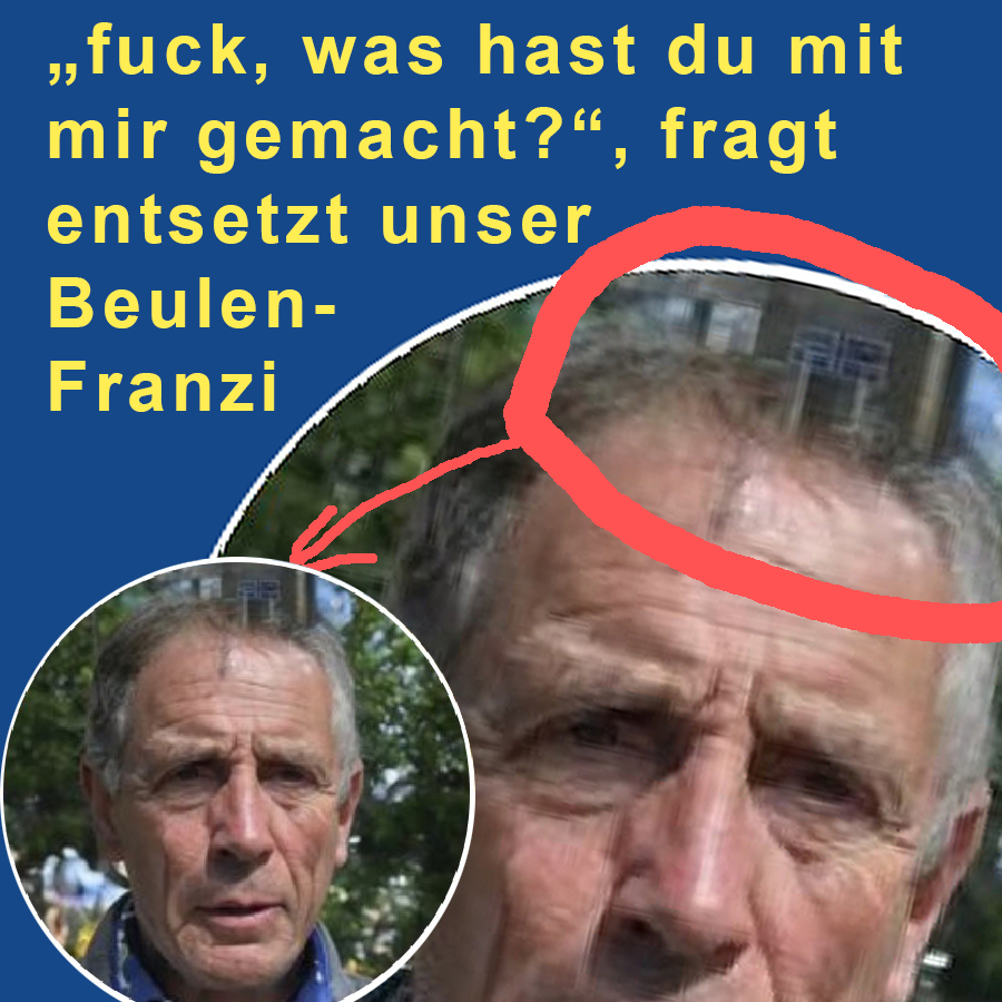 stalker-opa
